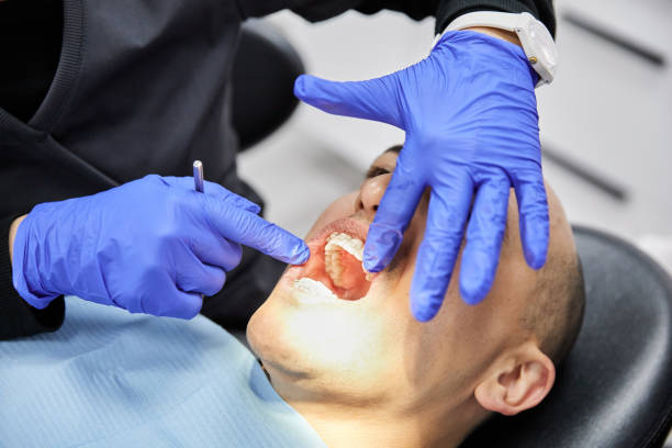 Best Broken or Chipped Tooth Repair in Orchard City, CO